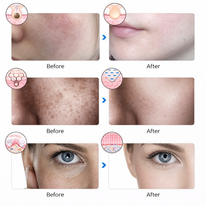 GLOW MASK ⎮ by Aderra™️